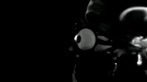 Вот так выглядит трение глаз на МРТ