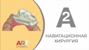 НАВИГАЦИОННАЯ ХИРУРГИЯ А2