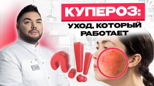 Как победить купероз? Простые алгоритмы / лайфхаки для здоровой кожи