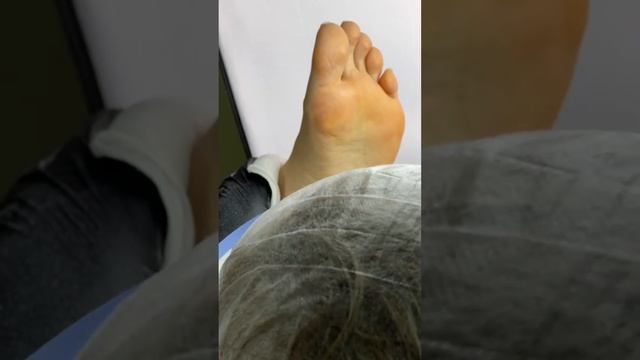 Результат! Вот причина почему клиент ходит на коллаген-педикюр
