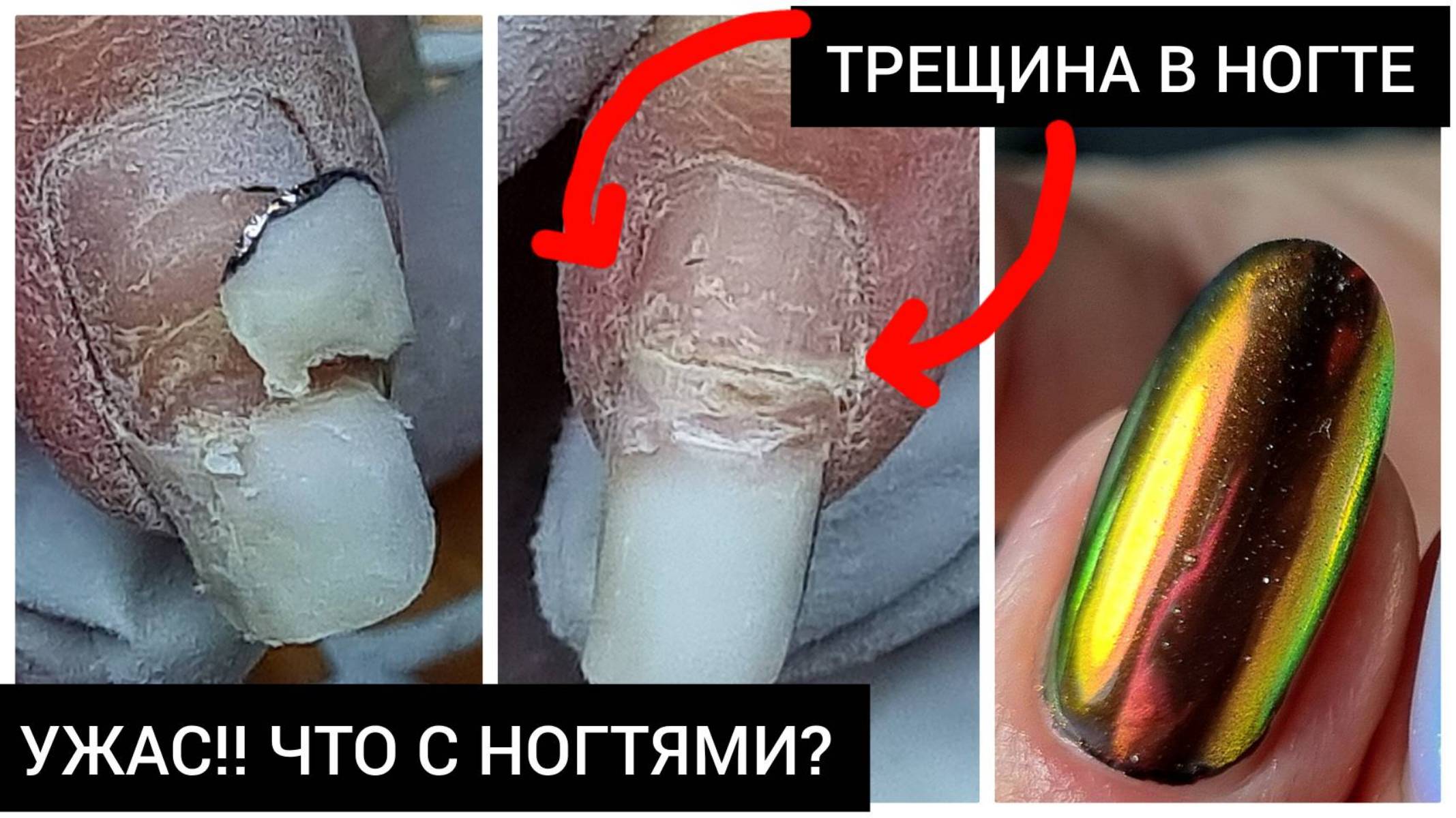 УЖАС!!!! ЧТО С НОГТЯМИ?