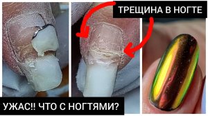 УЖАС!!!! ЧТО С НОГТЯМИ?