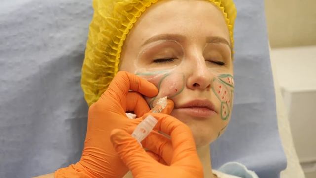 meso sculpt смотреть онлайн