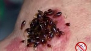 Уничтожение клопов в Москве