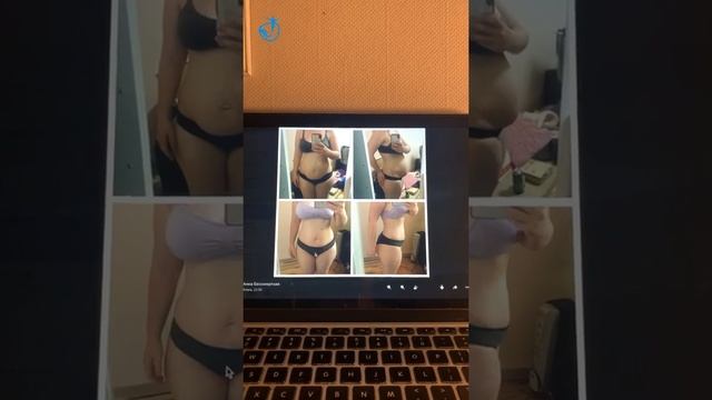 Как убрать торчащий живот и поднять внутренние органы