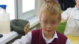 В Сочи две хаски напали на 9-летнего мальчика и превратили его лицо в кровавое месиво !!!