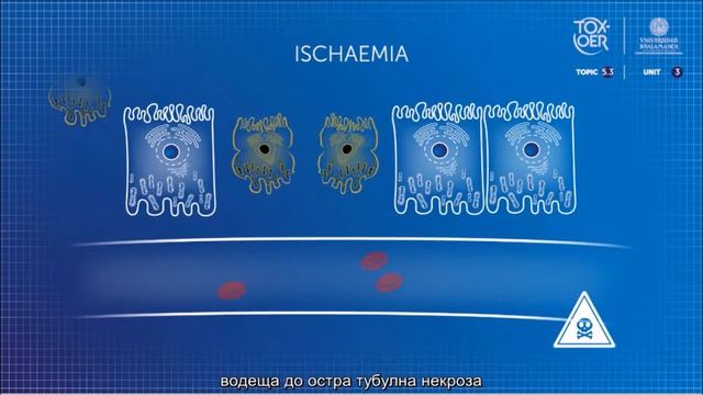 TOXOER 53 Kidney 31 Kidney response to toxic injury BUL