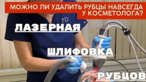 Шлифовка рубцов,  удаления шрамов лазерами и инъекциями- как выбрать?