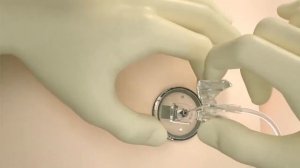 Игла Губера Surecan Safety II описание и преимущества, B Braun