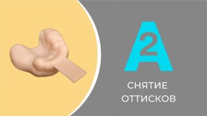 ПЕРЕНОС ИНФОРМАЦИИ О ПОЛОЖЕНИИ ИМПЛАНТАТА А 2 В ЛАБОРАТОРИЮ