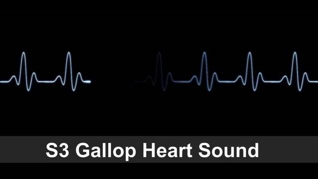 S3 Gallop   Heart Sound Collection For Auscultation Skills