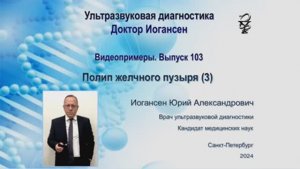 Ультразвуковая диагностика. Доктор Иогансен. Видеопримеры. Выпуск 103. Полип желчного пузыря (3).