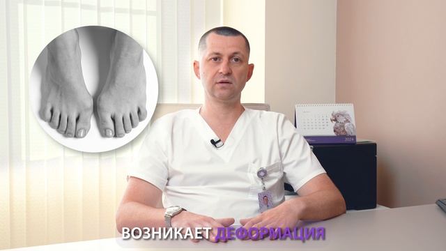 Как остановить рост косточки на большом пальце стопы?