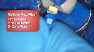 READY STEEL FlexoFiles