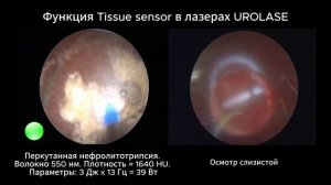 Функция Tissue sensor в лазерах линейки UROLASE