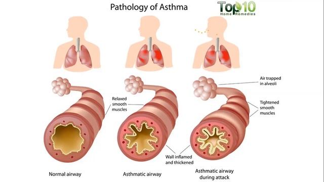 Essential Oils for Respiratory Support смотреть онлайн