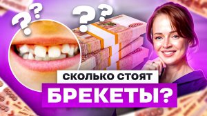 Самые ДОРОГИЕ и самые ДЕШЕВЫЕ БРЕКЕТЫ. В чем разница?