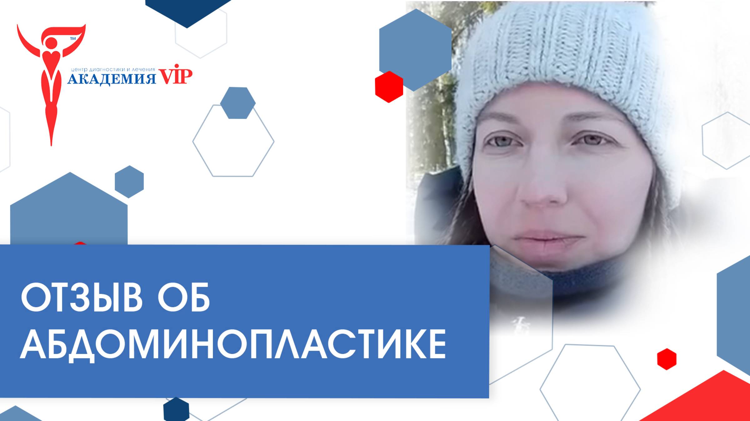 Отзыв об абдоминопластике в «Академии VIP»