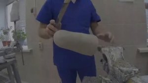 Изготовление модульного протеза нижней конечности
