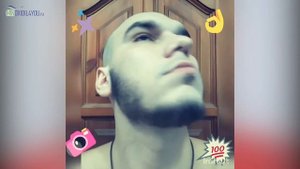 Миноксидил для бороды отзыв через полтора года применения миноксидила. Minoxidil4you