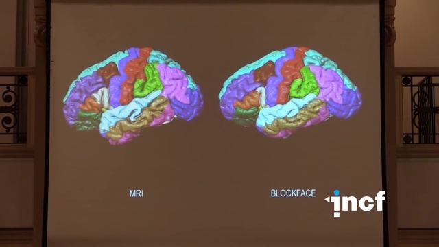 Jacopo Annese - The digital renaissance of human neuroanatomy (2014)