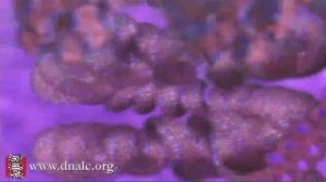 How DNA is Packaged (Basic)