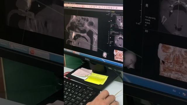 "Компьютерная томография в стоматологии"