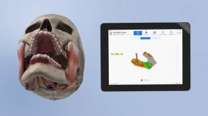 Стоматологическая система OccluSense для диагностики окклюзии