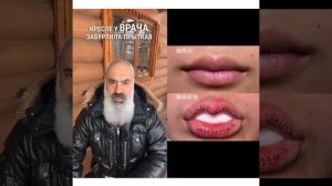 💋 Губы-ласточки – новый шизо-тренд! 💉