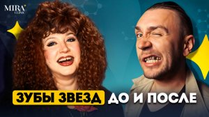 ЗУБЫ ЗВЁЗД: кто сделал виниры удачно, а кто — ЗРЯ? Mira Clinic