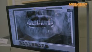 Операция по наращиванию мягких тканей