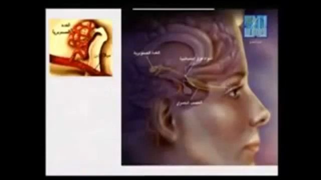 РАК ЦАМГАРАХ МУХА ЛАР ВАЛА ВЕЗА смотреть онлайн