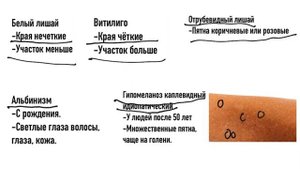 Белый лишай. Сыпь. #подготовкакusmle#сыпь#белыйлишай