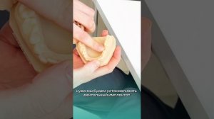 Изготовление и применение хирургических шаблонов