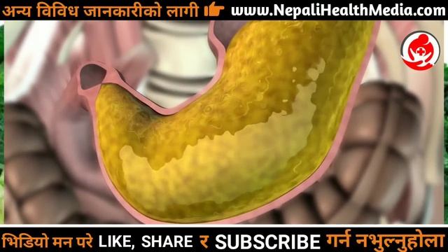 पेट फुल्ने कारणहरु Sign and symptoms of stomach bloating || Nepali Health Tips