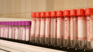 СДАЧА АНАЛИЗОВ В DIVUS 💉