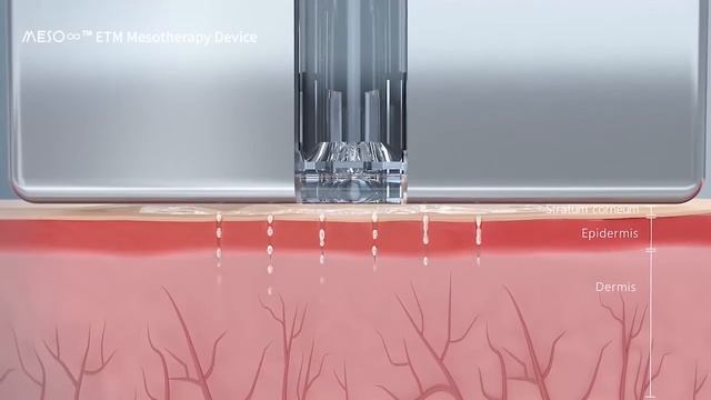 MESO∞ Non-invasive Mesotherapy Device Working Theory Video