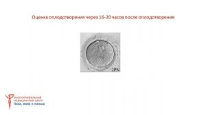 Эмбриологический этап программы ЭКО