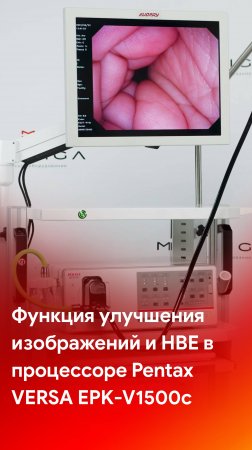 Функция улучшения изображений и HBE в видеопроцессоре Pentax Versa EPK-V1500c