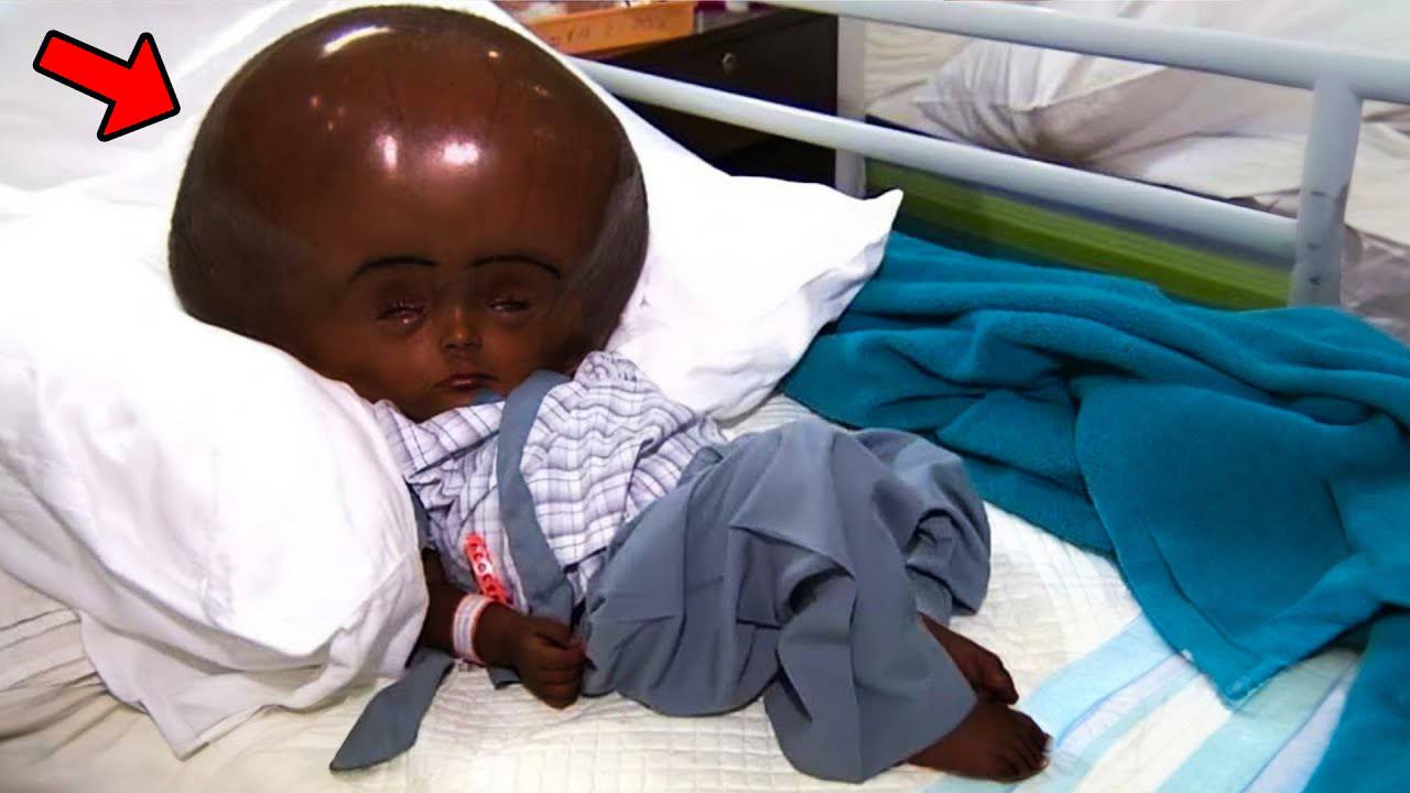 Помните девочку с самой большой головой в мире? Вот что с ней произошло смотреть онлайн