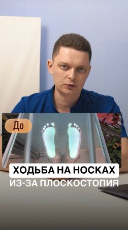 Ходьба на носках из-за плоскостопия ❌