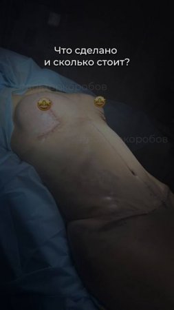 Комплексная операция | Сколько стоит?