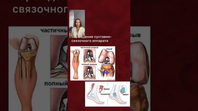 СУСТАВЫ: травма без ТРАВМ