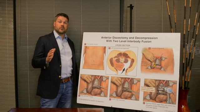 If My Case Goes to Trial, Will It Always Be Determined by Jury? | Q&A with Personal Injury Attorney смотреть онлайн