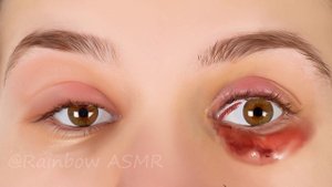 ASMR Remove Ant & Maggot Infected Dirty Eyes | Deep Cleaning Animation