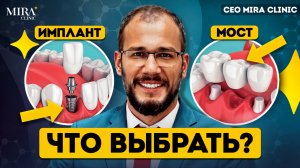 Имплантация или мост? Какой метод восстановления зубов ЛУЧШЕ. Mira Clinic