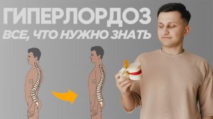 Настоящая причина гиперлордоза. Как исправить гиперлордоз в спине, современные данные.