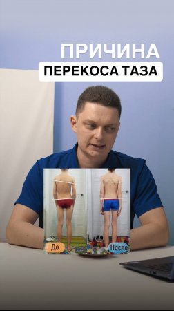 Причина перекоса таза