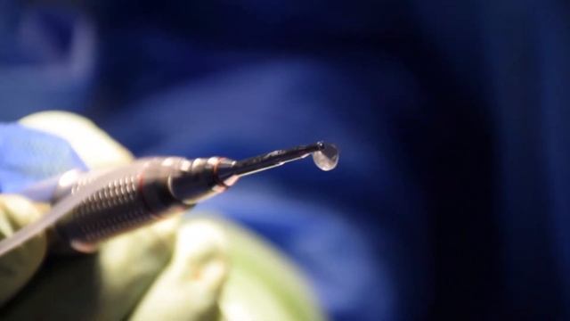 Риносептопластика в деталях смотреть онлайн