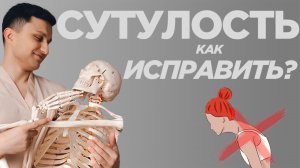 Как исправить СУТУЛОСТЬ? Гиперкифоз, ИСКРИВЛЕНИЕ в грудном отделе. Современные методы.